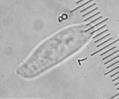 The paramecium in this fig occupies only 3 subdivisions=0.2mm