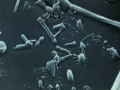 slide18_microscopicPhoto
