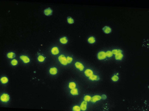 slide20_500microscopic3
